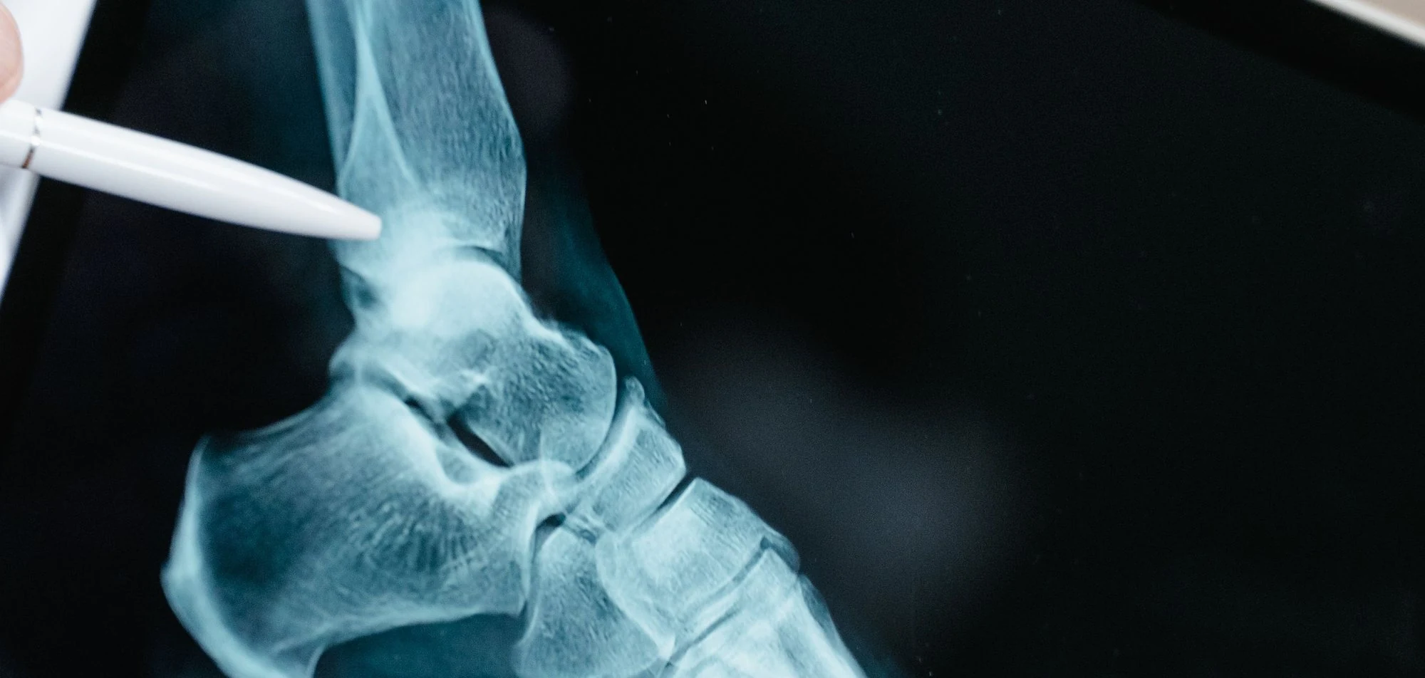 A clinician reviewing a foot X-ray